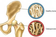kremelina-zdrave_kosti